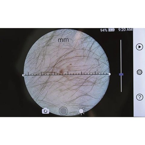 Medyczny system kamer diagnostycznych RCS-100 dermatoskop, otoskop + kamera