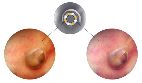 Otoskop Luxamed Auris CCT LED - Luxascope dwie barwy światła
