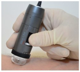 Dermatoskop DINO-LITE MEDL4DW (VIDEODERMATOSKOP)